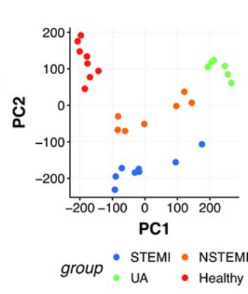 PCA of differentially methylated regions associated with ACS severity