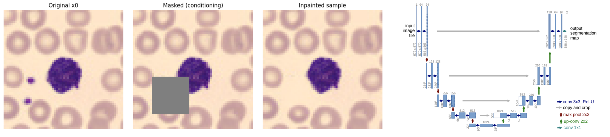 Original, masked, and inpainted blood-cell image alongside a U-Net architecture diagram