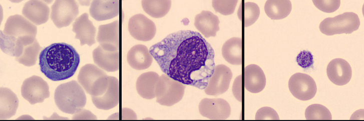 Examples of blood-cell types