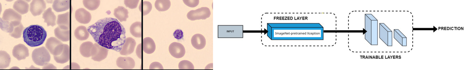 Blood-cell images alongside a frozen, ImageNet-pretrained Xception and trainable MLP classifier